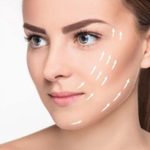 Facial Thread Lift amateur pic Facial Thread Lift